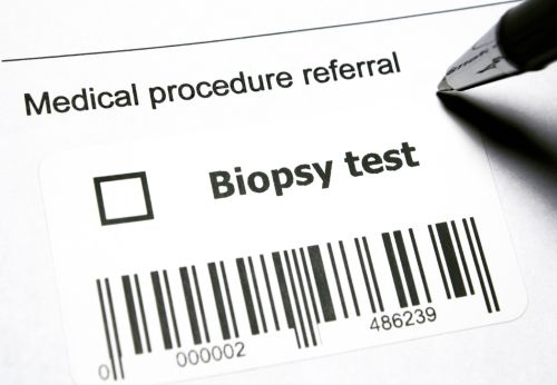 Biopsy test sticker for the lab