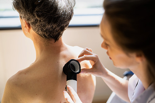 dermatologist performing a skin exam on a patient