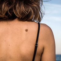 May is Skin Cancer Awareness Month