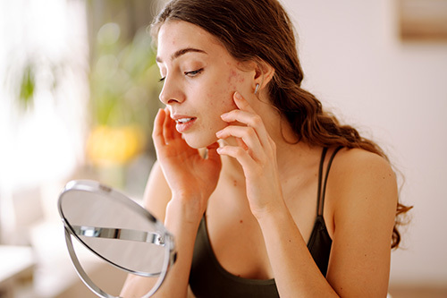 Teenage woman looking in the mirror at the acne on her face