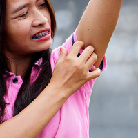 Understanding Hidradenitis Suppurativa: Symptoms, Causes, and Treatment Options 